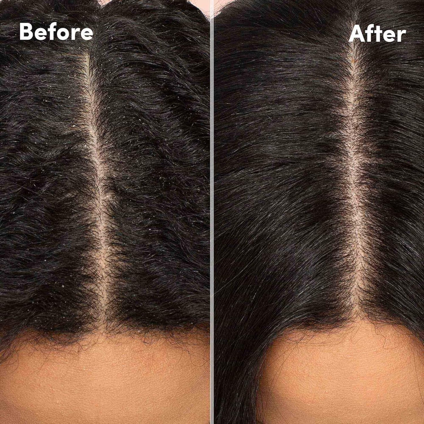 Mizani | Scalp Care / Shampoo