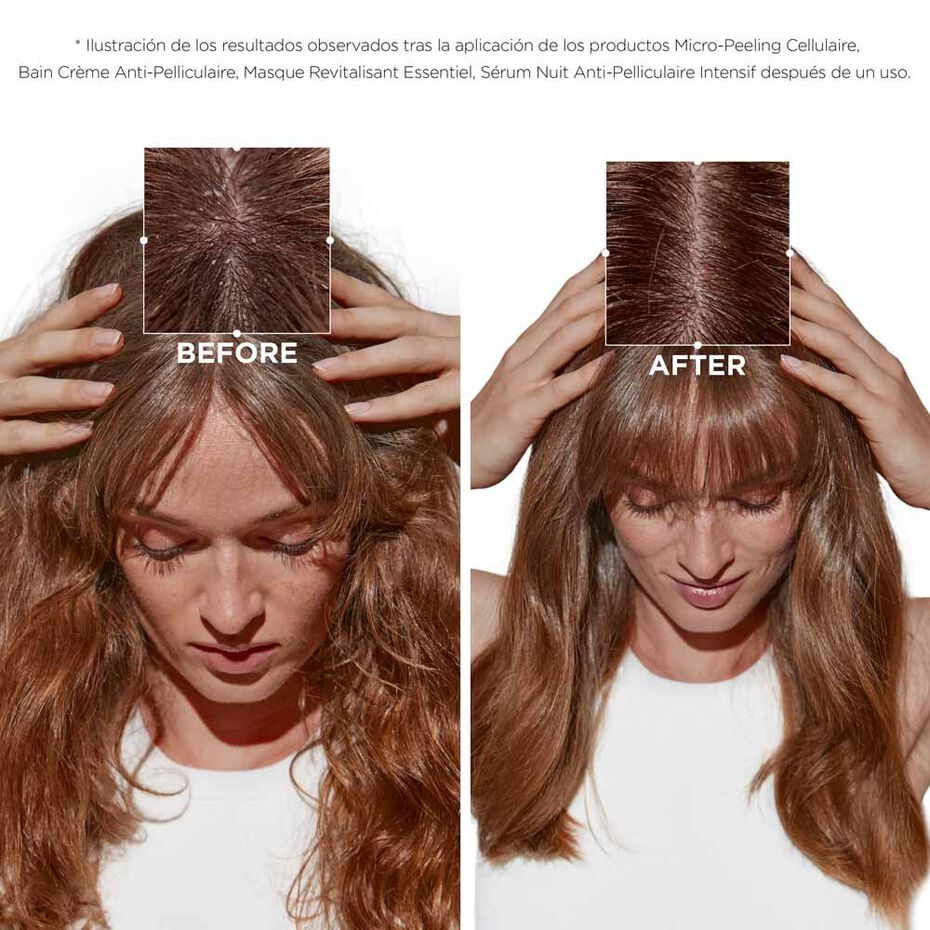 Kérastase | Symbiose / Micro-Peeling Cellulaire
